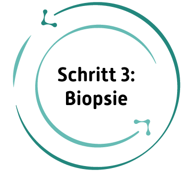 Ultraschallpositionierung System SoLo A mit Template zur Nadelpositionierung