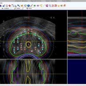 LDR Brachytherapy software JetSpeed5 für CT / MR / Ultraschall-Nachplanungsprozesse