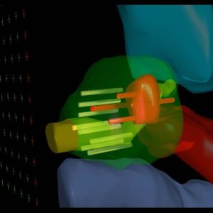 BioJet MRI-Fusionbiopsies by MTT Precise biopsies including 3D reconstruction in real time