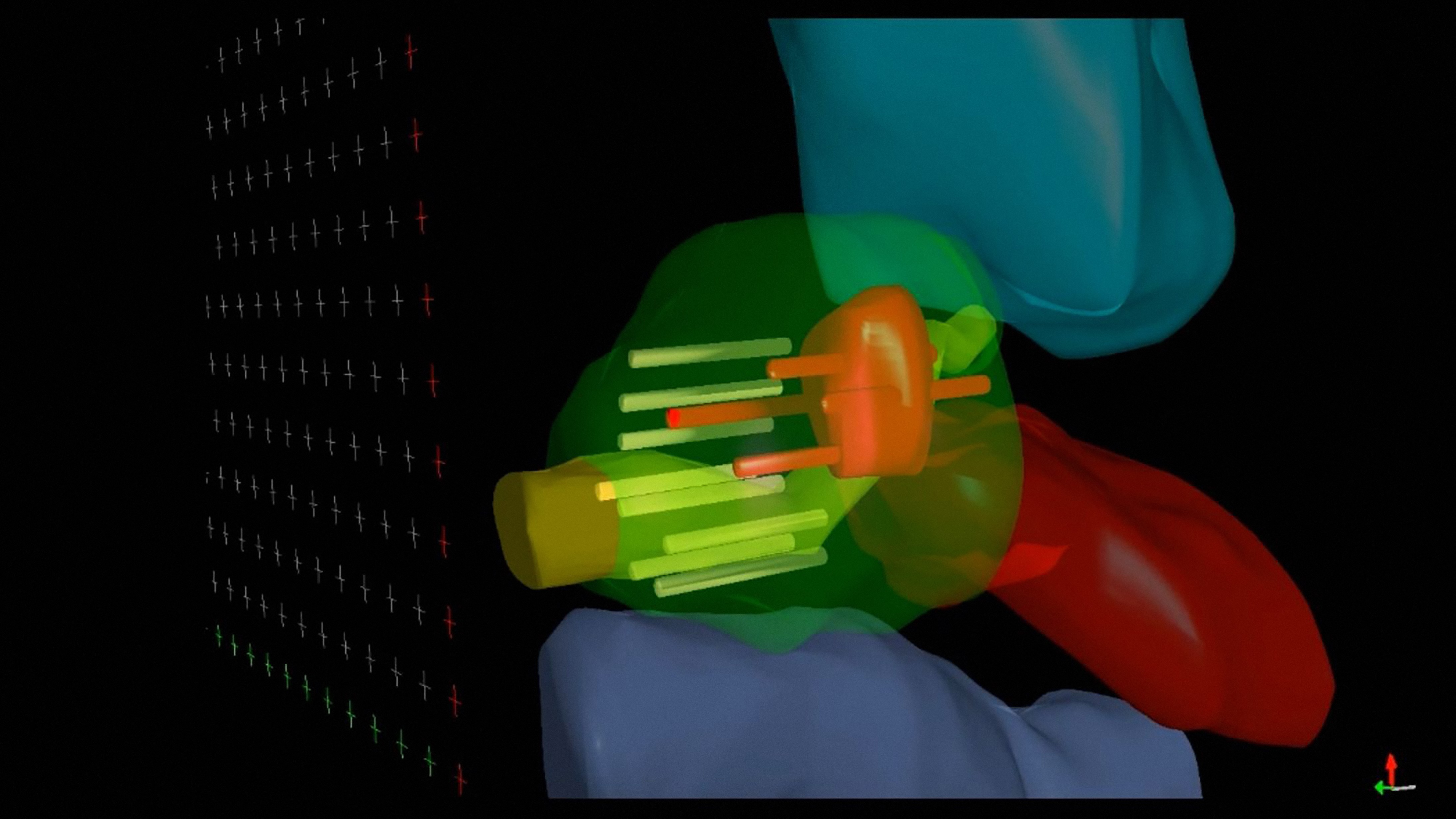 Urological positioning system SoLo A precise and reliable system for sound head and needle positioning