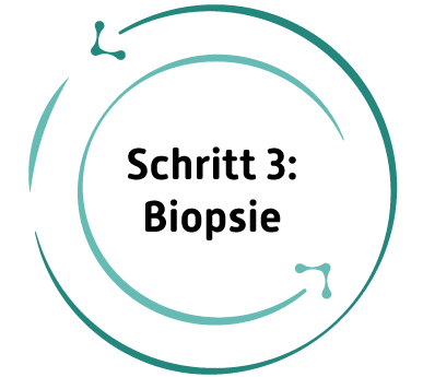 Schritt 3: Biopsie